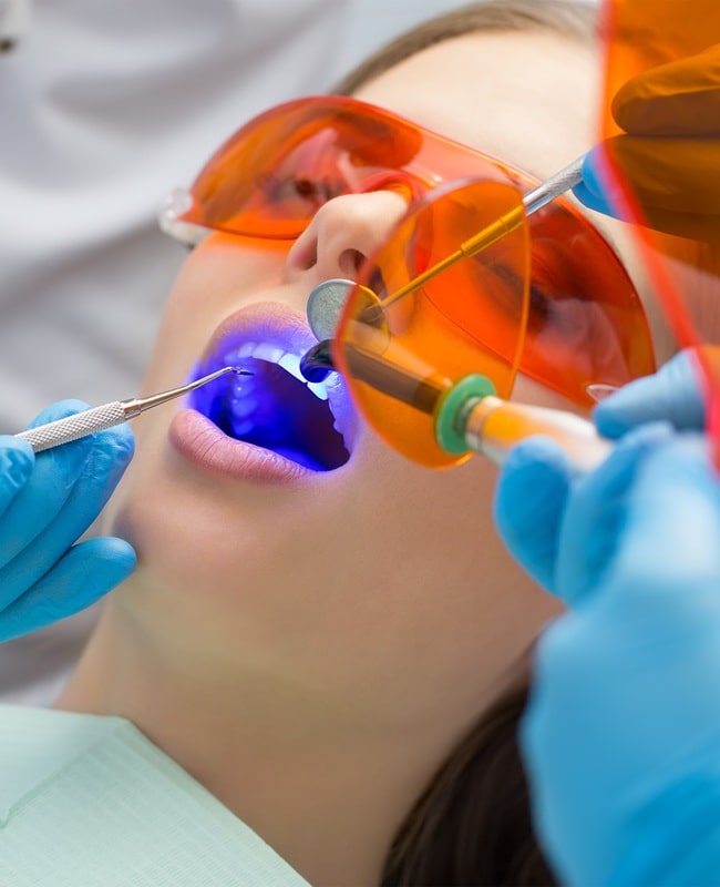 dental-fillings